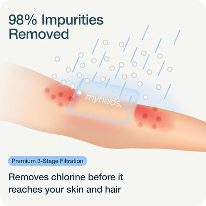 MyHalos Handheld Filtered Shower Head, High Pressure, Removes Chlorine | Filtered Cartridge, Reduces Chlorine & Heavy Metals, Easy Install, No Tools, Detachable, Universal Fit for Hard Water