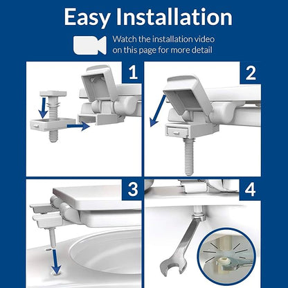 Bemis Aurora Slow Close Toilet Seat, Easy Clean Hinges and Adjustable Perfect Fit Plastic Seat, Made in USA, Elongated, White