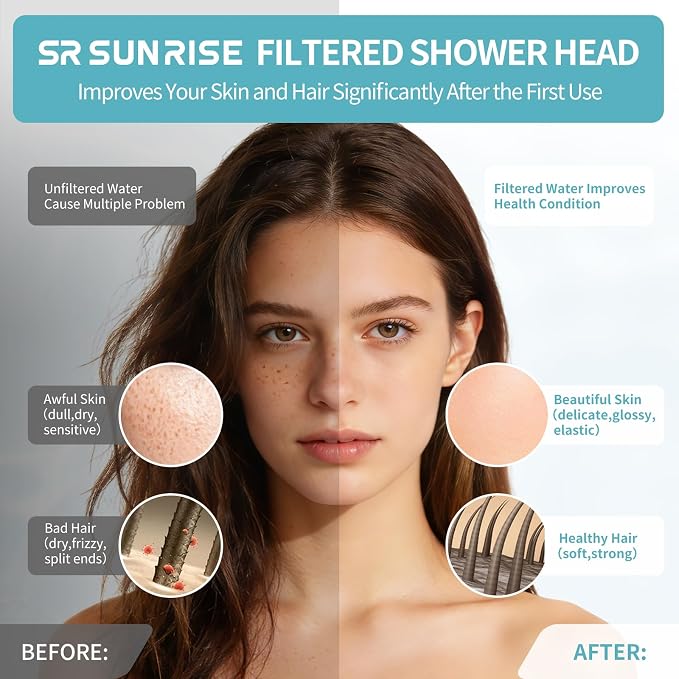 SR SUN RISE Filtered Shower Head with Filters, 20-Stage Shower Head Filter for Hard Water, Fixed Showerhead with Easy-Replace Cartridge to Remove Chlorine & Heavy Metals (7-Inch, Chrome)