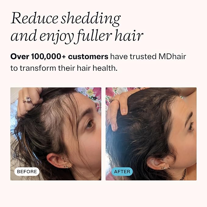 Mounted & Handheld Filtered Shower Head Bundle for Hard Water | Multi-stage filters remove chlorine & heavy metals for healthier hair & skin; dermatologist-formulated, high pressure
