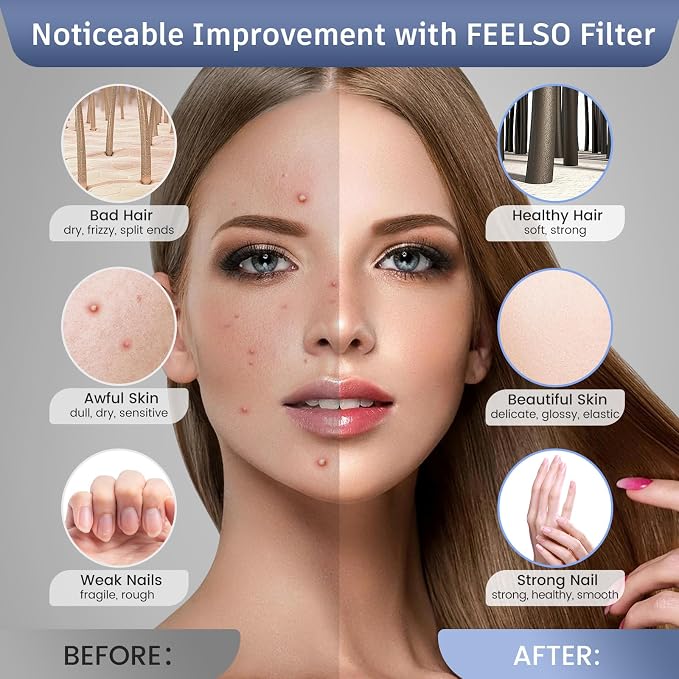 FEELSO LED Filtered Shower Head，High Pressure Rain Shower Head with Filters | Light Color Changing, 7 Modes, Water Softener Shower Head for Hard Water, Remove Chlorine，Reduces Dry Itchy Skin & Hair