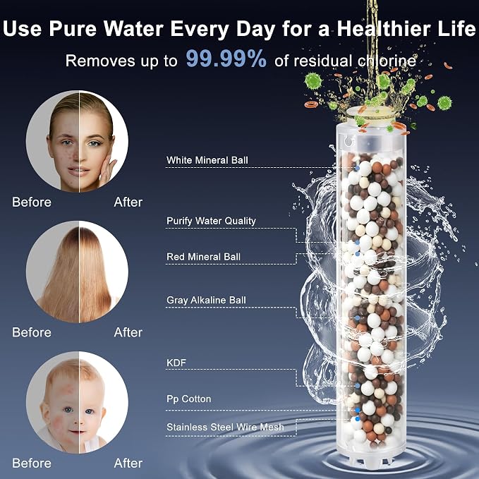 Filtered Shower Head with Handheld, High Pressure 7-Spd Showerhead | Shower Head with Stainless Hose,Water Softener Filter Beads for Hard Water,Remove Chlorine, Reduce Dry Itchy Skin