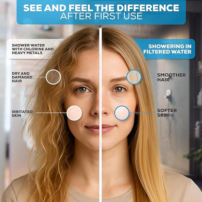 SparkPod Filtered Shower Head, 23-Stage, 8" Round, Oil-Rubbed Bronze | Showerhead for Hard Water, High Pressure, Reduces Chlorine, Heavy Metals, For Dry Skin & Hair, Removable Capsule Filter